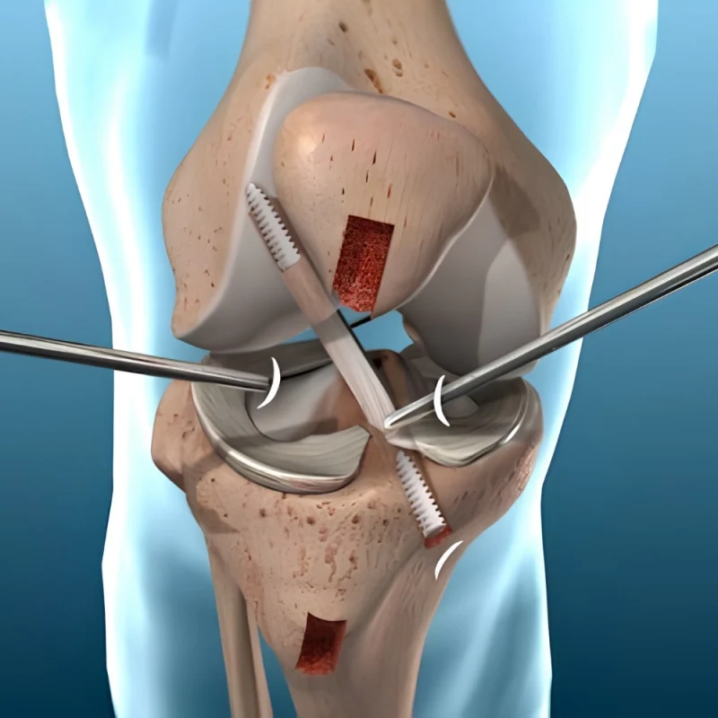 Dr.RahulSinha5-ezgif.com-optiwebp